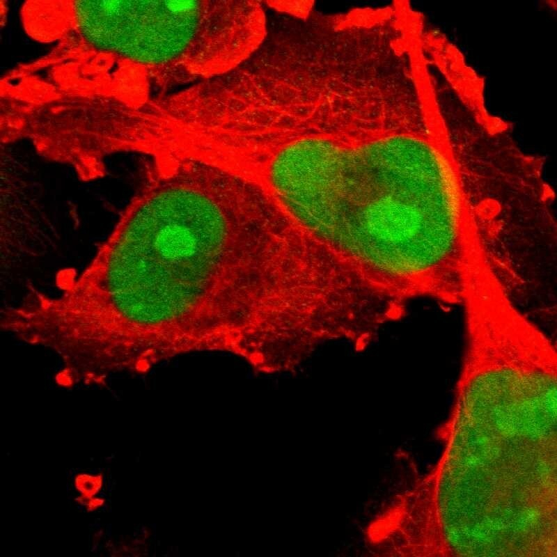PHF6 Antibody - BSA Free Immunocytochemistry/ Immunofluorescence: PHF6 Antibody [NBP1-88646]