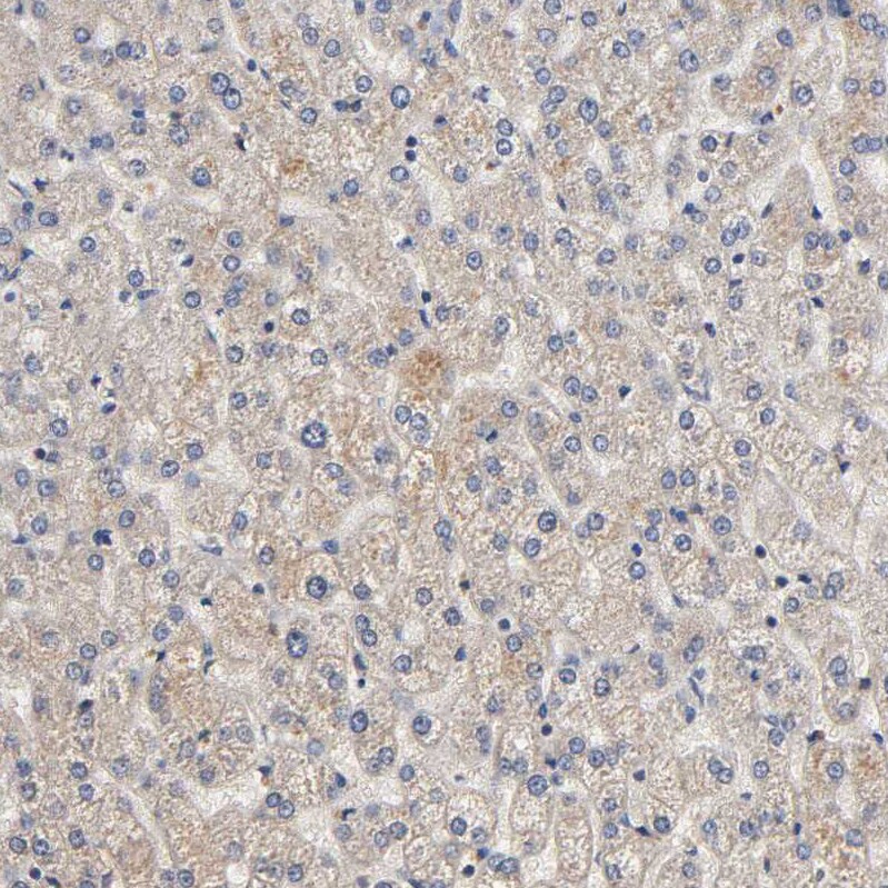 ARHGEF7 Antibody - BSA Free Immunohistochemistry-Paraffin: ARHGEF7 Antibody [NBP1-88650]