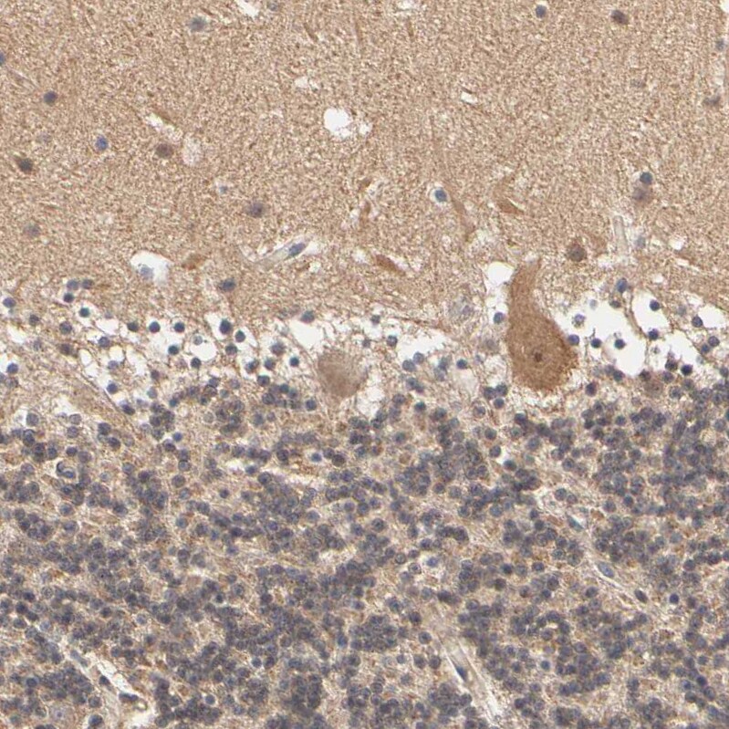 ARHGEF7 Antibody - BSA Free Immunohistochemistry-Paraffin: ARHGEF7 Antibody [NBP1-88650]