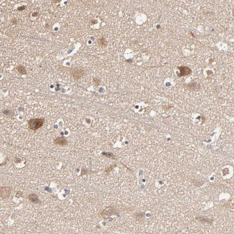 ARHGEF7 Antibody - BSA Free Immunohistochemistry-Paraffin: ARHGEF7 Antibody [NBP1-88650]