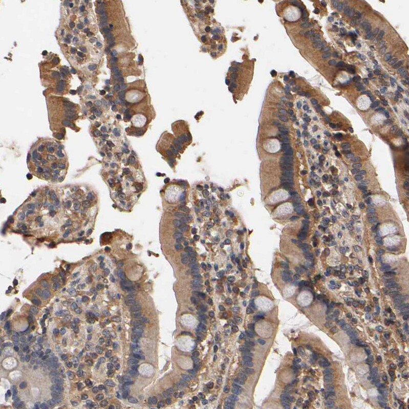 ARHGEF7 Antibody - BSA Free Immunohistochemistry-Paraffin: ARHGEF7 Antibody [NBP1-88650]