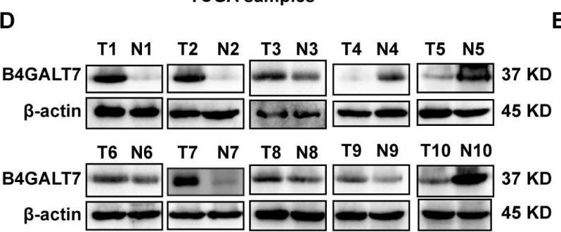 B4GALT7 Antibody - BSA Free