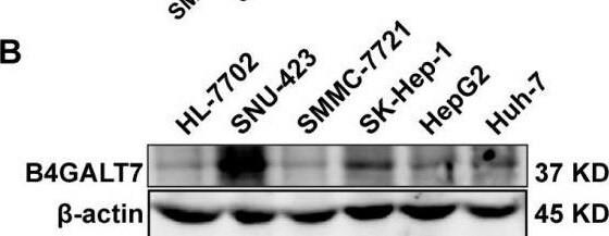 B4GALT7 Antibody - BSA Free