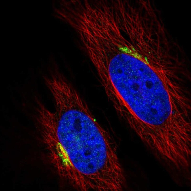 beta-1,4-Galactosyltransferase 1/B4GalT1 Antibody - BSA Free Immunocytochemistry/ Immunofluorescence: beta-1,4-Galactosyltransferase 1/B4GalT1 Antibody [NBP1-88655]