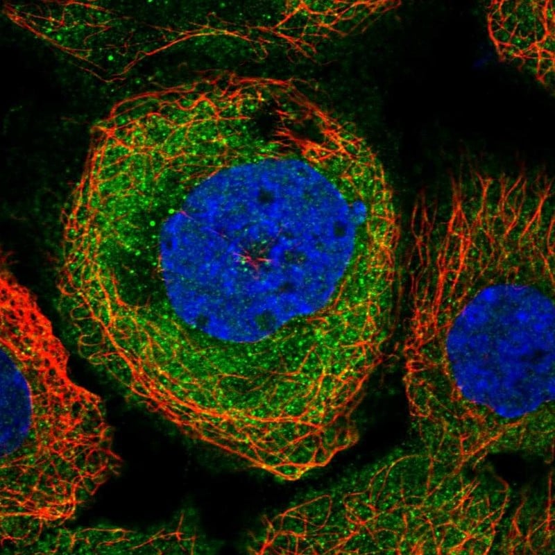 PSMB10/MECL1 Antibody - BSA Free Immunocytochemistry/ Immunofluorescence: PSMB10/MECL1 Antibody [NBP1-88660]