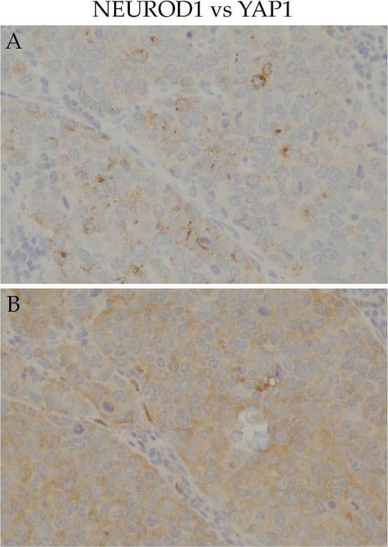 NeuroD1 Antibody
