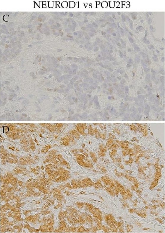 NeuroD1 Antibody