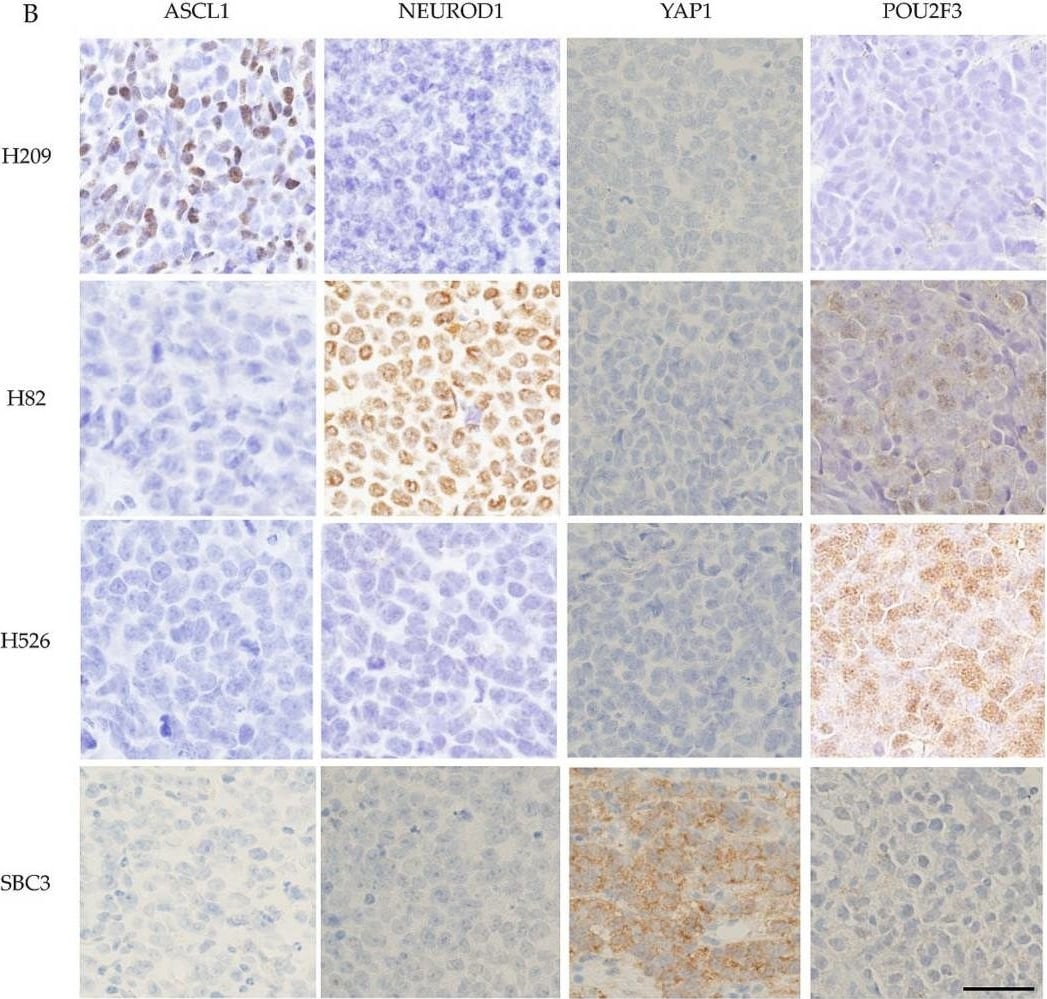 NeuroD1 Antibody