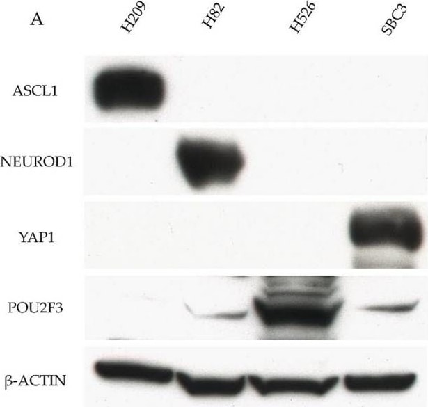 NeuroD1 Antibody