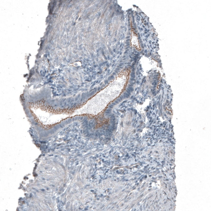 FGFR2 Antibody - BSA Free Immunohistochemistry: FGFR2 Antibody - BSA Free [NBP1-88670]