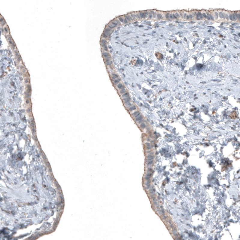 FGFR2 Antibody - BSA Free Immunohistochemistry: FGFR2 Antibody - BSA Free [NBP1-88670]