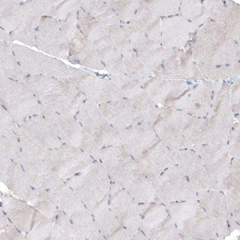 FGFR2 Antibody - BSA Free Immunohistochemistry: FGFR2 Antibody - BSA Free [NBP1-88670]