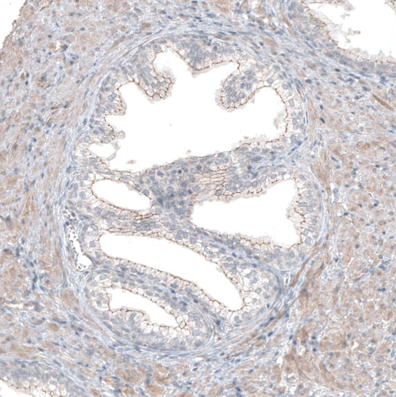 FGFR2 Antibody - BSA Free Immunohistochemistry: FGFR2 Antibody - BSA Free [NBP1-88670]