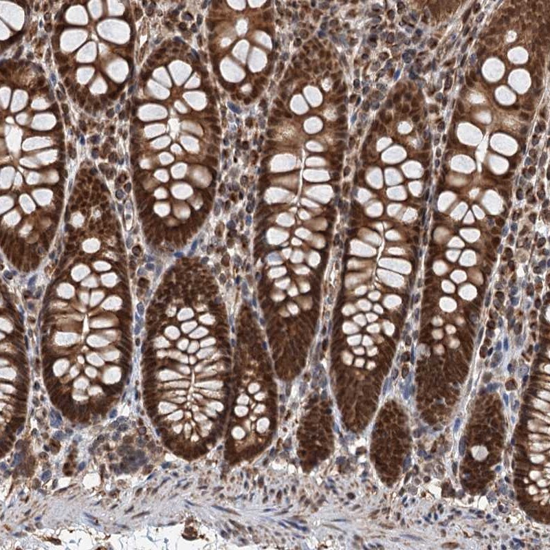 Craniofacial Development Protein 1 Antibody - BSA Free Immunohistochemistry: Craniofacial Development Protein 1 Antibody - BSA Free [NBP1-88680]