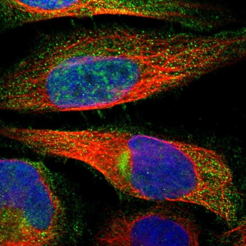 ZNHIT6 Antibody - BSA Free Immunocytochemistry/ Immunofluorescence: ZNHIT6 Antibody [NBP1-88683]