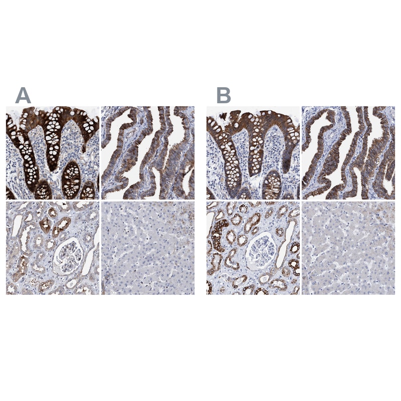 MKS1 Antibody - BSA Free Immunohistochemistry-Paraffin: MKS1 Antibody [NBP1-88692]