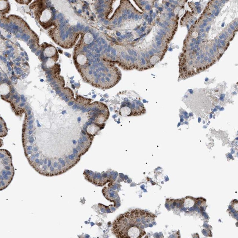 SFXN5 Antibody - BSA Free Immunohistochemistry: SFXN5 Antibody - BSA Free [NBP1-88696]