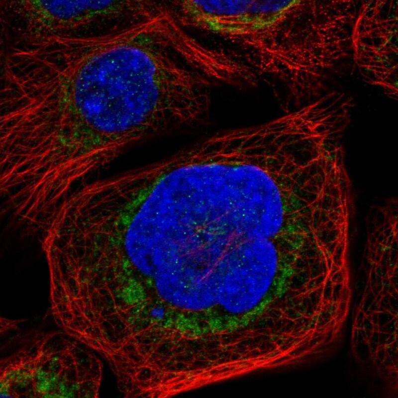 Bad Antibody - BSA Free Immunocytochemistry/ Immunofluorescence: Bad Antibody [NBP1-88698]