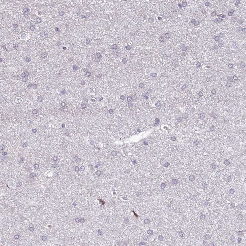 BANK1 Antibody - BSA Free Immunohistochemistry-Paraffin: BANK1 Antibody [NBP1-88714]