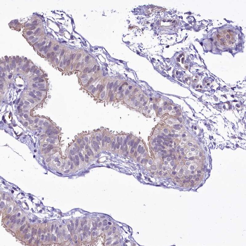 BANK1 Antibody - BSA Free Immunohistochemistry-Paraffin: BANK1 Antibody [NBP1-88714]