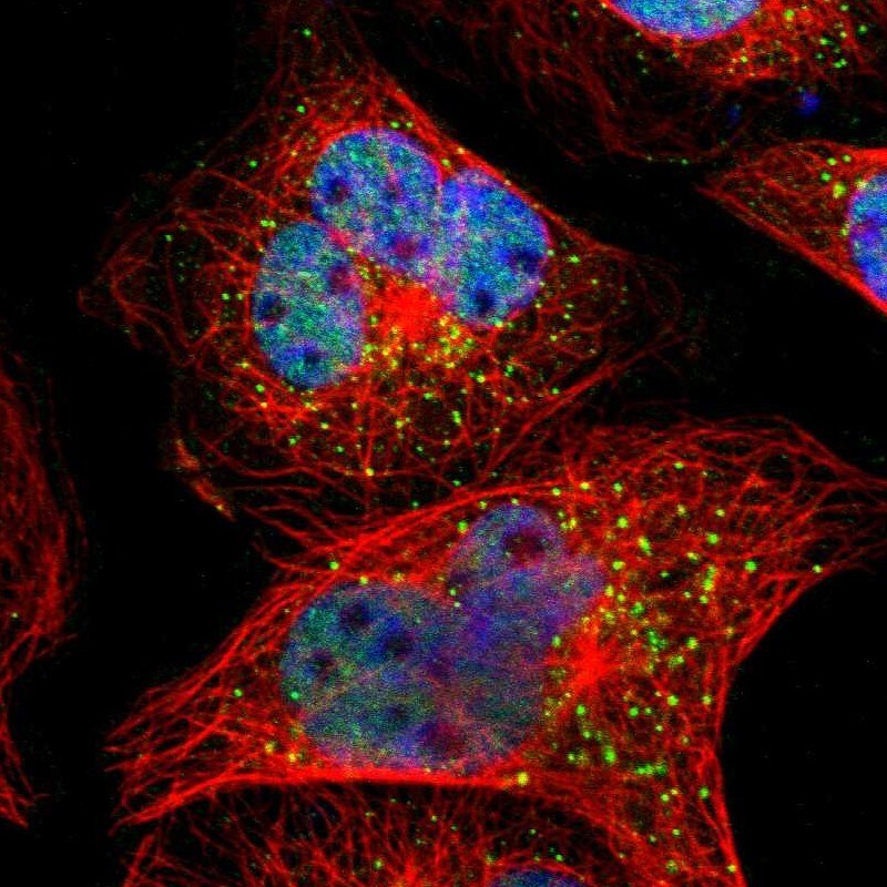 SMARCD1 Antibody - BSA Free Immunocytochemistry/ Immunofluorescence: SMARCD1 Antibody [NBP1-88719]