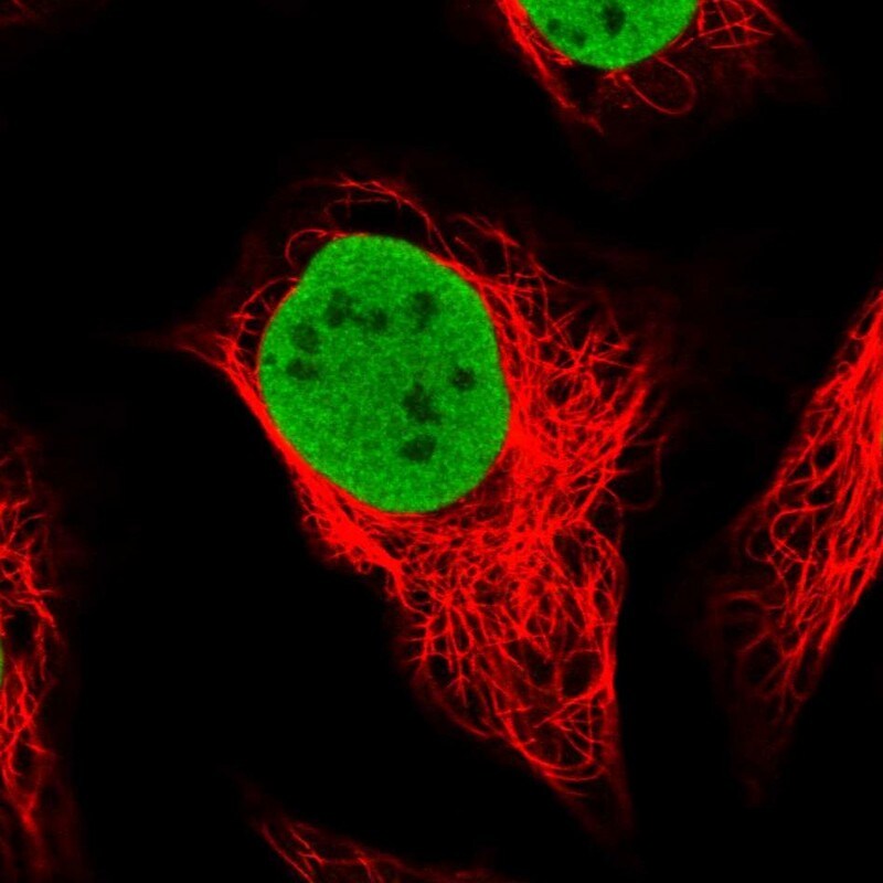 SMARCC1 Antibody - BSA Free Immunocytochemistry/ Immunofluorescence: SMARCC1 Antibody [NBP1-88720]