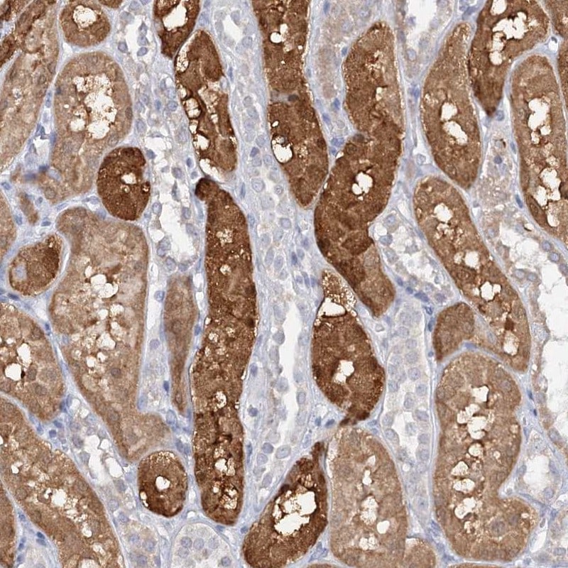 SFRS18 Antibody - BSA Free Immunohistochemistry-Paraffin: SFRS18 Antibody [NBP1-88723]