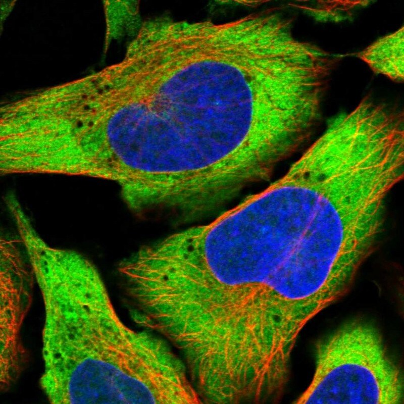 PDSS2 Antibody - BSA Free Immunocytochemistry/ Immunofluorescence: PDSS2 Antibody [NBP1-88739]