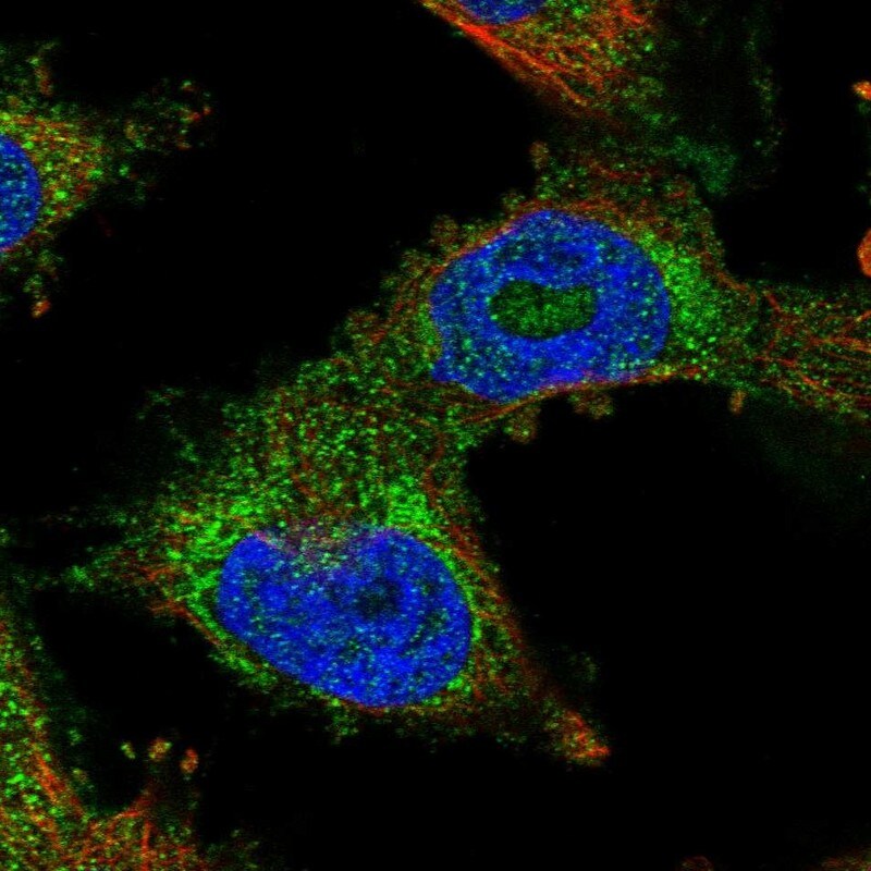 PDSS2 Antibody - BSA Free Immunocytochemistry/ Immunofluorescence: PDSS2 Antibody [NBP1-88740]