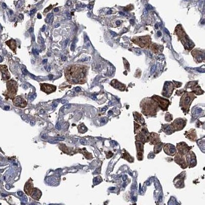 RTKN2 Antibody Immunohistochemistry-Paraffin: RTKN2 Antibody [NBP1-88748]