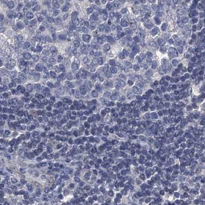 RTKN2 Antibody Immunohistochemistry-Paraffin: RTKN2 Antibody [NBP1-88748]