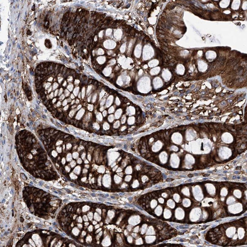 ZNF484 Antibody - BSA Free Immunohistochemistry-Paraffin: ZNF484 Antibody [NBP1-88750]