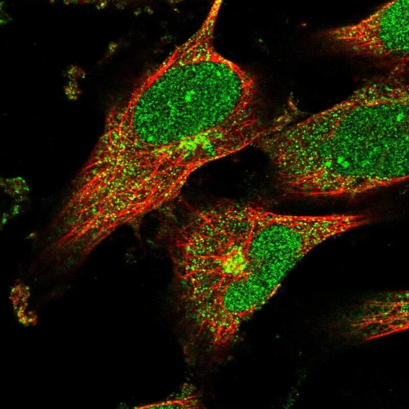 PPIL6 Antibody - BSA Free Immunocytochemistry/ Immunofluorescence: PPIL6 Antibody [NBP1-88766]