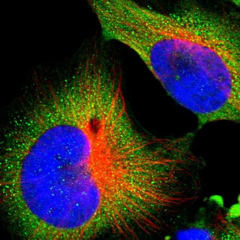 ALG5 Antibody - BSA Free Immunocytochemistry/ Immunofluorescence: ALG5 Antibody [NBP1-88767]