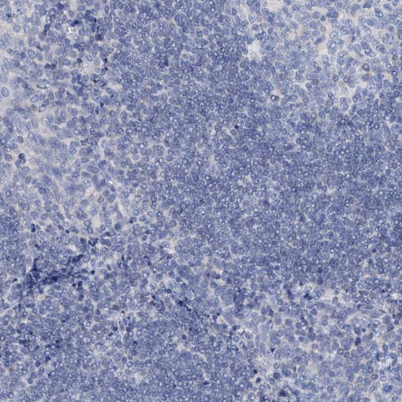 DTD1 Antibody - BSA Free Immunohistochemistry-Paraffin: DTD1 Antibody [NBP1-88776]