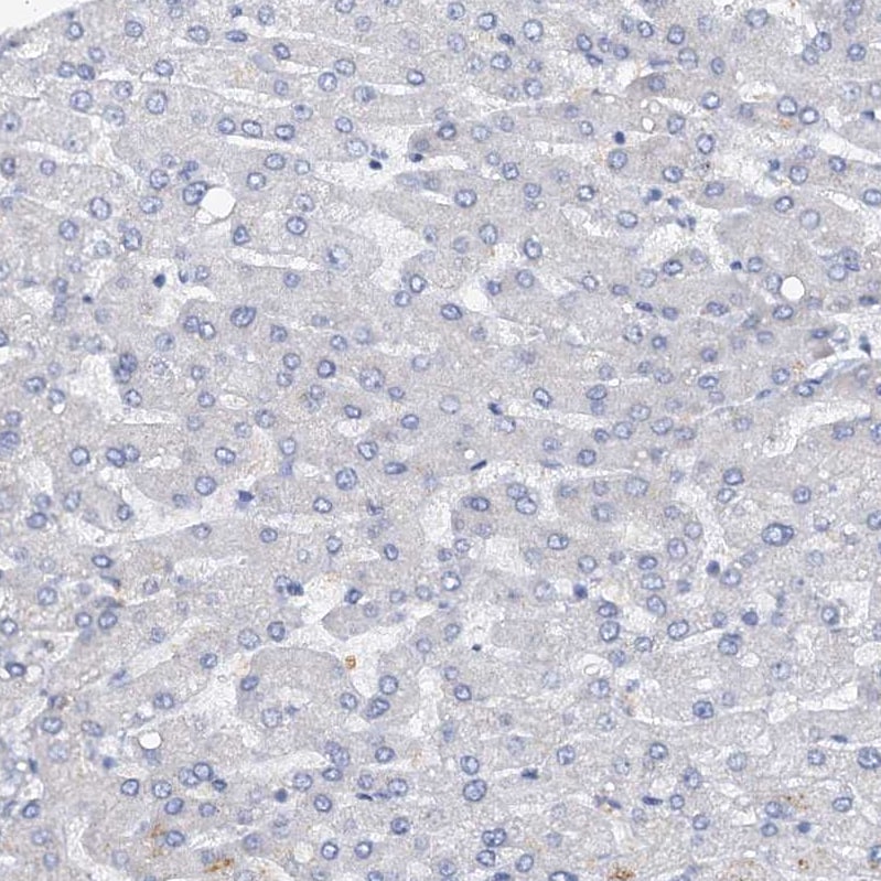 DTD1 Antibody - BSA Free Immunohistochemistry-Paraffin: DTD1 Antibody [NBP1-88776]