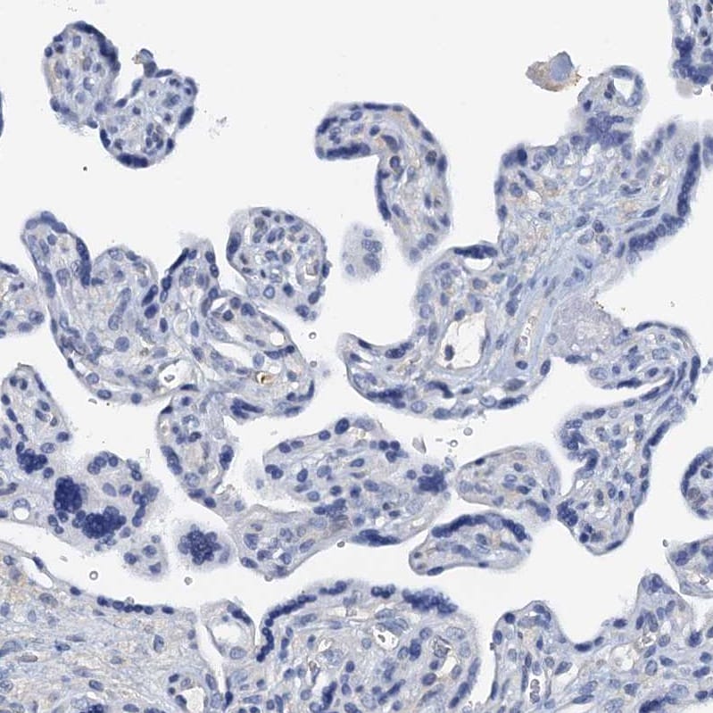 DTD1 Antibody - BSA Free Immunohistochemistry-Paraffin: DTD1 Antibody [NBP1-88776]
