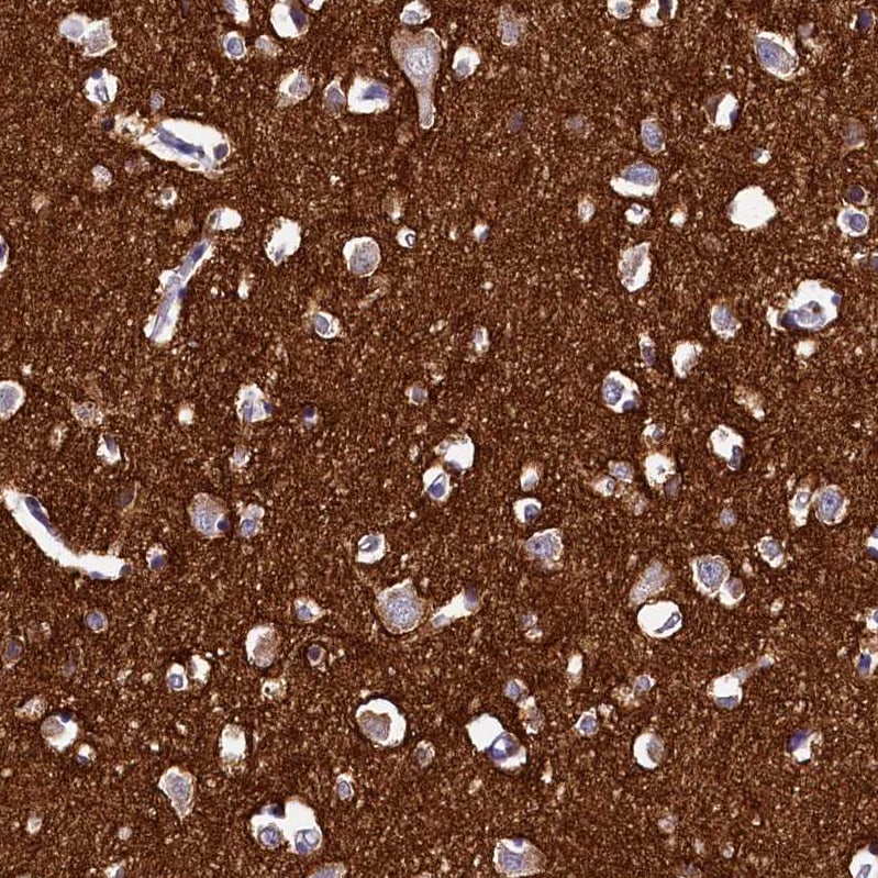 DTD1 Antibody - BSA Free Immunohistochemistry-Paraffin: DTD1 Antibody [NBP1-88776]