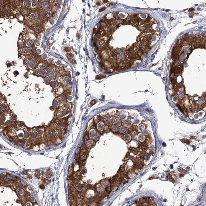 DYDC1 Antibody - BSA Free Immunohistochemistry-Paraffin: DYDC1 Antibody [NBP1-88779]