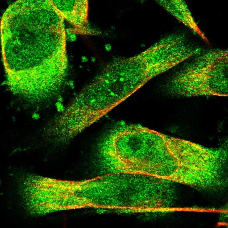 PHPT1 Antibody Immunocytochemistry/Immunofluorescence: PHPT1 Antibody [NBP1-88804]