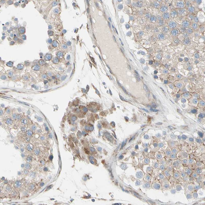 FNDC3A Antibody - BSA Free Immunohistochemistry-Paraffin: FNDC3A Antibody [NBP1-88809]