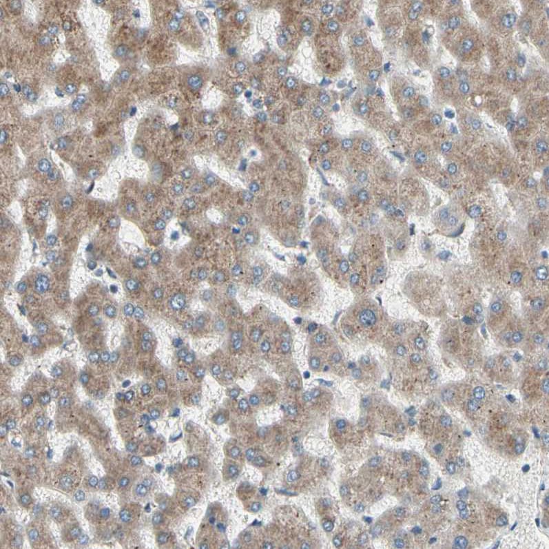 FNDC3A Antibody - BSA Free Immunohistochemistry-Paraffin: FNDC3A Antibody [NBP1-88809]