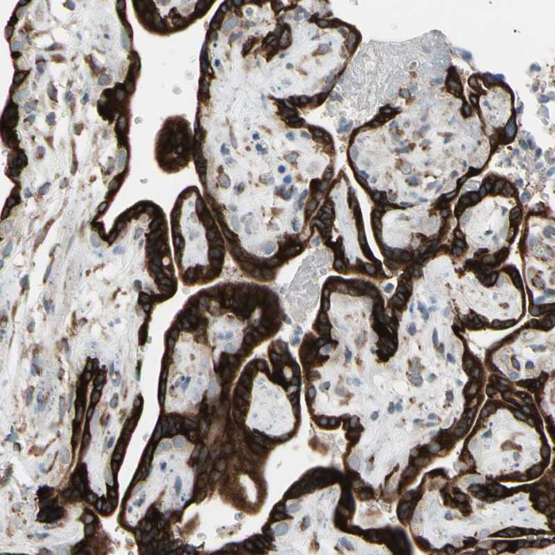 FNDC3A Antibody - BSA Free Immunohistochemistry-Paraffin: FNDC3A Antibody [NBP1-88809]