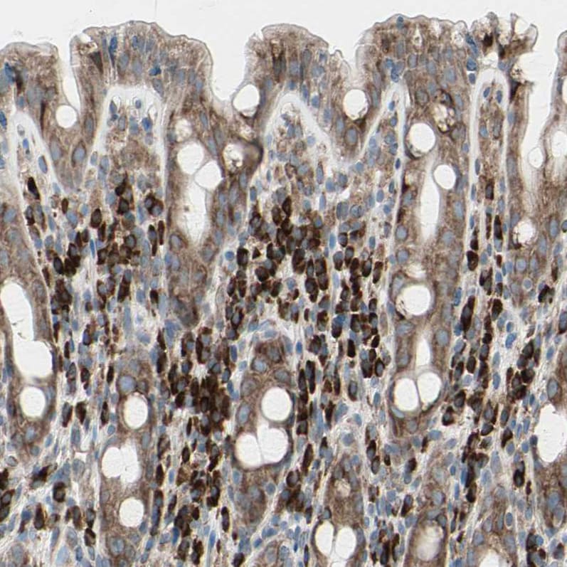 FNDC3A Antibody - BSA Free Immunohistochemistry-Paraffin: FNDC3A Antibody [NBP1-88809]