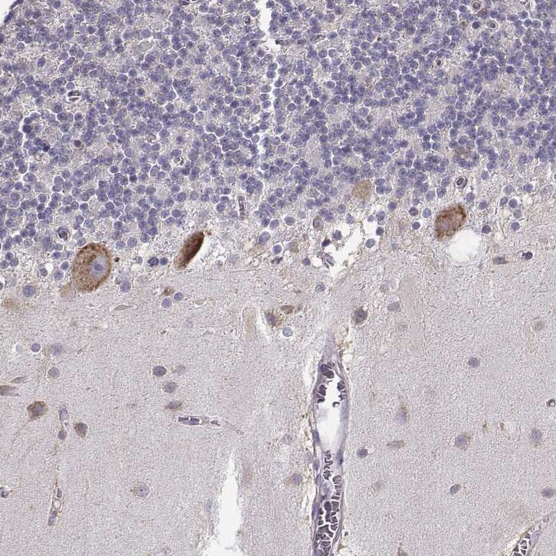 Bend6 Antibody - BSA Free Immunohistochemistry-Paraffin: Bend6 Antibody [NBP1-88811]