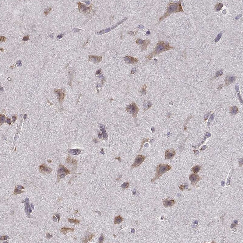Bend6 Antibody - BSA Free Immunohistochemistry-Paraffin: Bend6 Antibody [NBP1-88811]