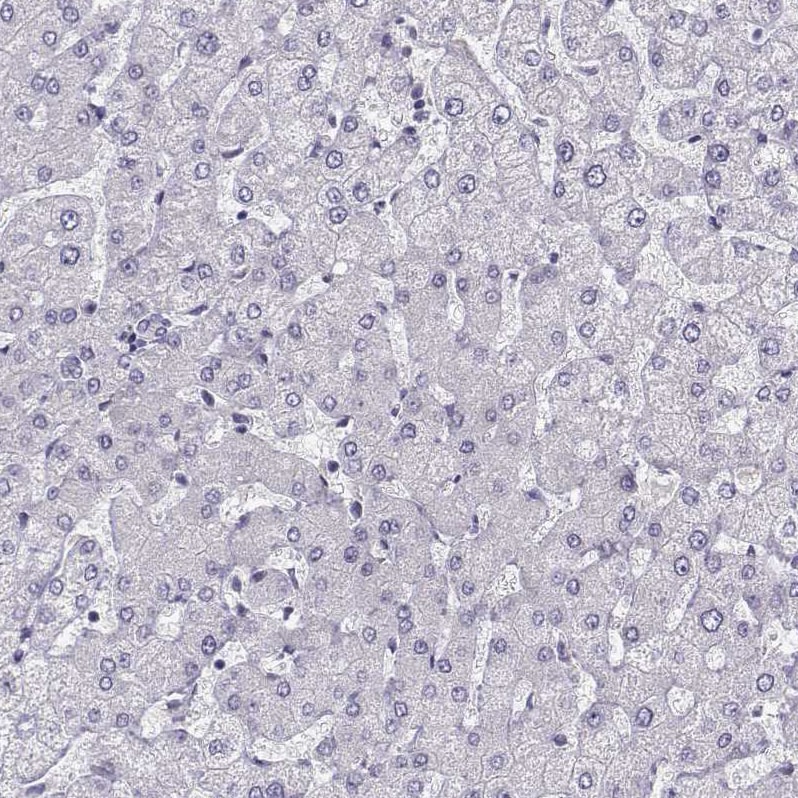 Bend6 Antibody - BSA Free Immunohistochemistry-Paraffin: Bend6 Antibody [NBP1-88811]