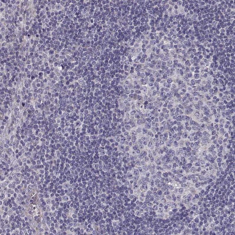 Bend6 Antibody - BSA Free Immunohistochemistry-Paraffin: Bend6 Antibody [NBP1-88811]