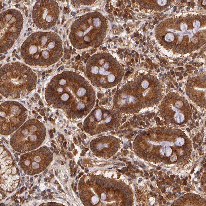 ASCC2 Antibody - BSA Free Immunohistochemistry-Paraffin: ASCC2 Antibody [NBP1-88815]