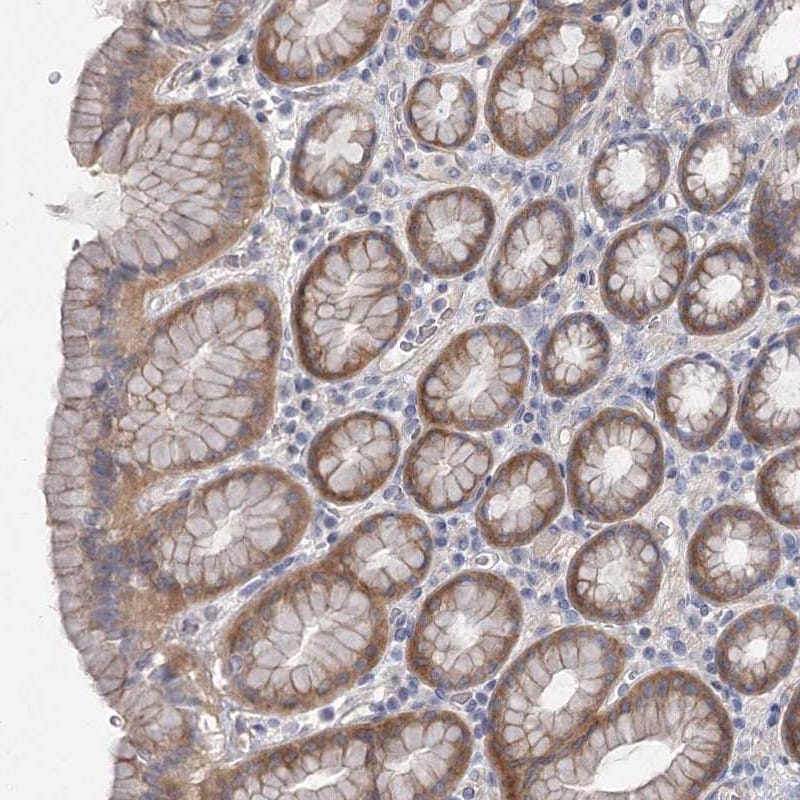 DNMBP Antibody - BSA Free Immunohistochemistry: DNMBP Antibody - BSA Free [NBP1-88817]